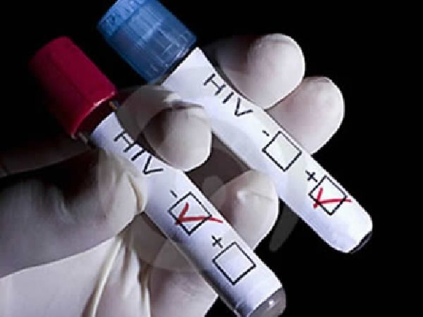 Test rÃ¡pido de detecciÃ³n de HIV-SIDA